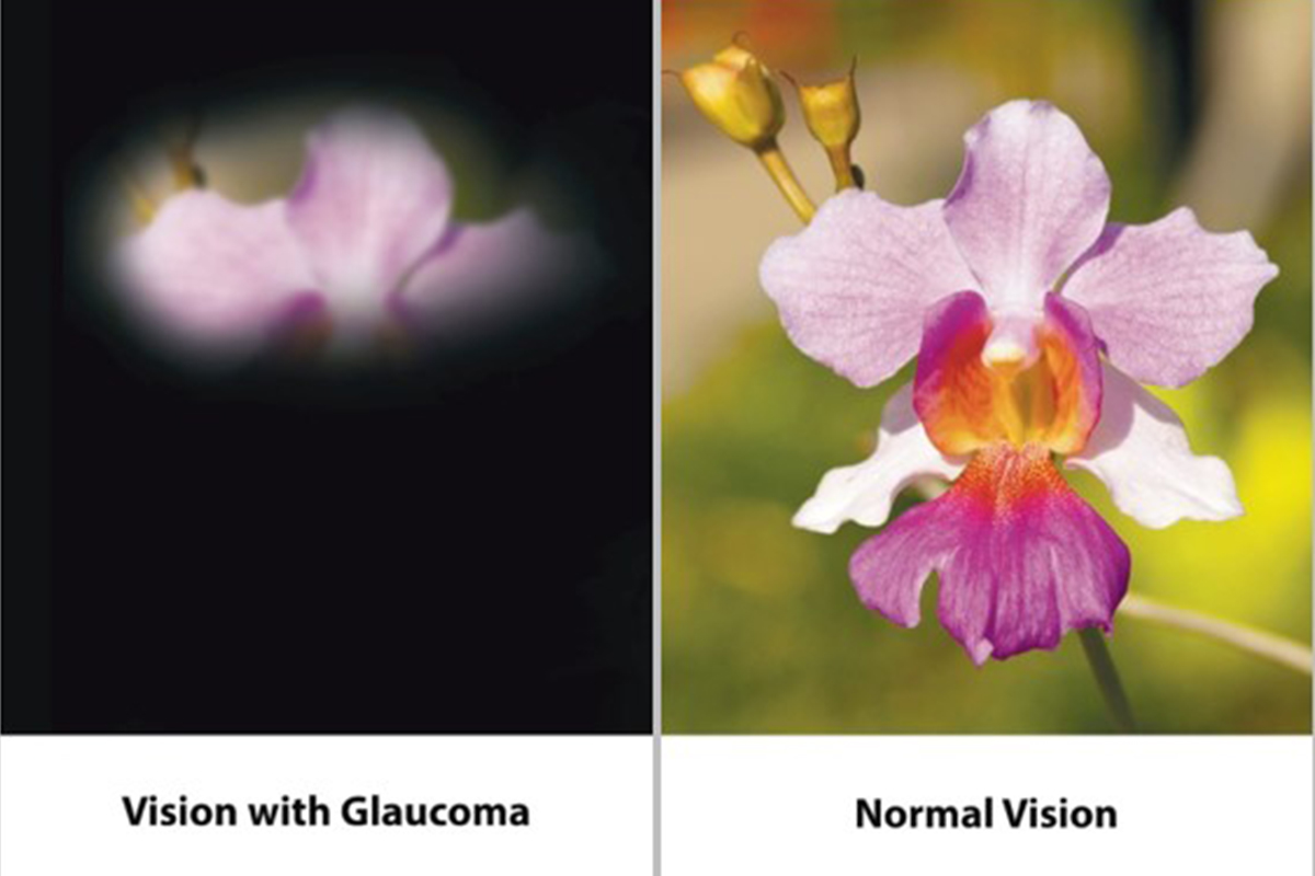 Redness, 'panda eyes', sagging lids How to get rid of cosmetic side